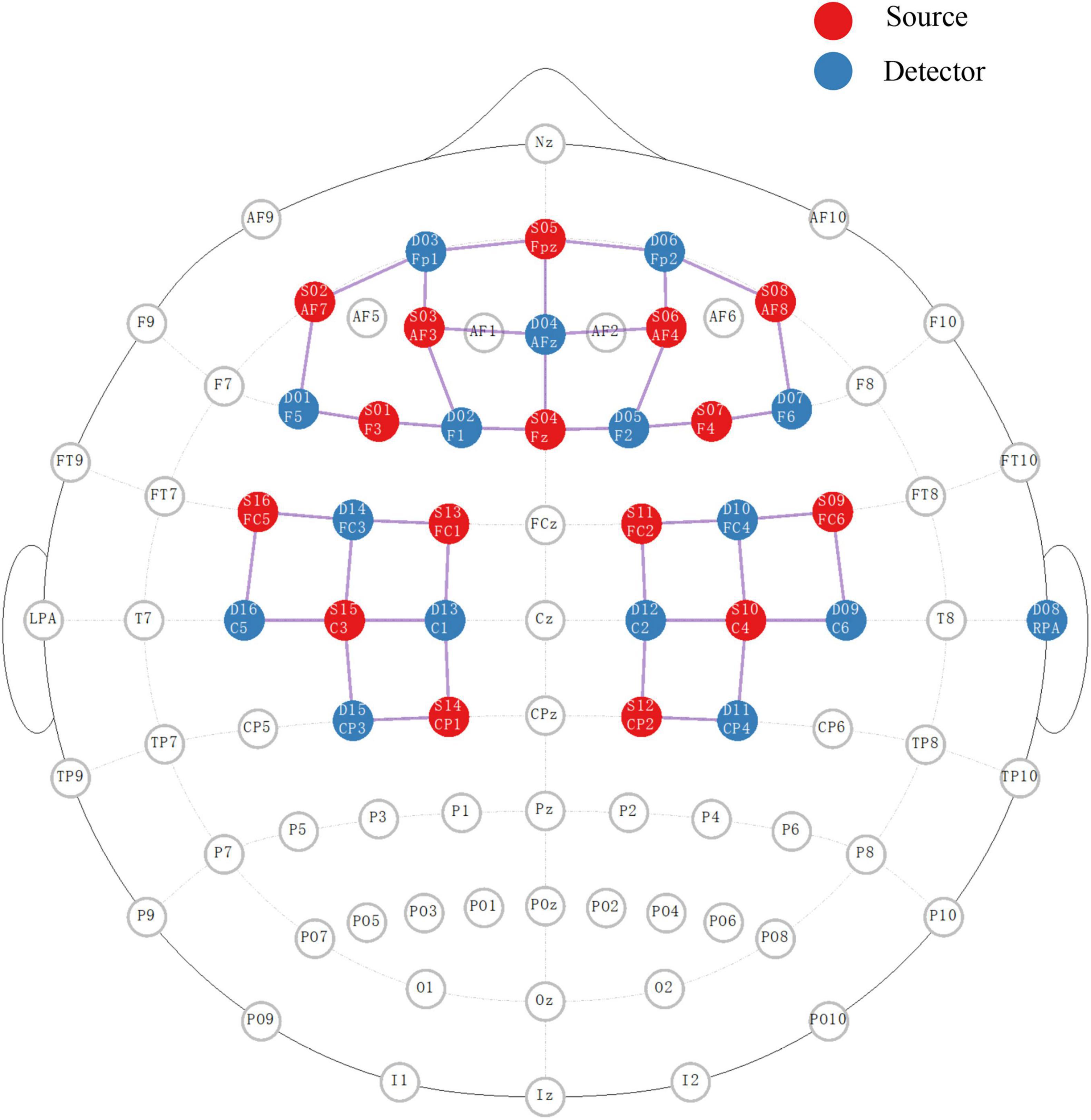 Altered frontoparietal activity in acoustic startle priming tasks during reticulospinal tract facilitation: An fNIRS study